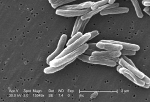 tuberculosis